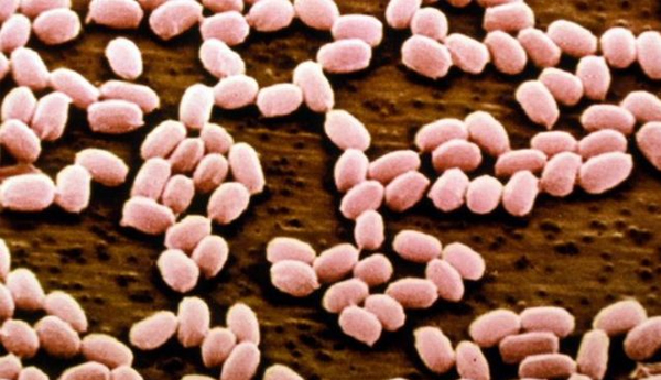 Anthrax Outbreak Affects in Nnorth Russia