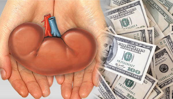 Selling Kidney to go to Australia