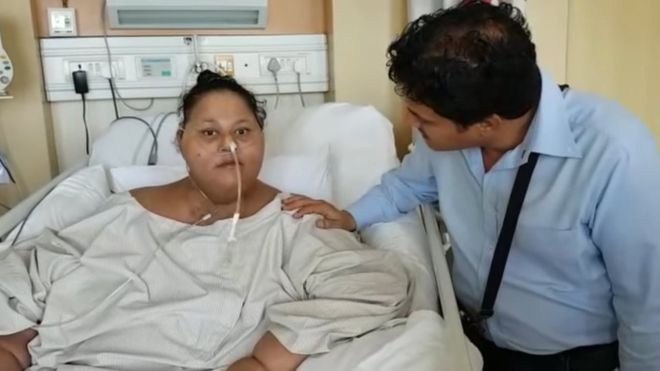 ‘Heaviest Woman’ Leaves India for UAE after ‘Losing 250kg’