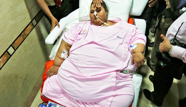 Eman Ahmed, World’s Heaviest Woman Undergoing Treatment, Passes Away In Abu Dhabi Hospital