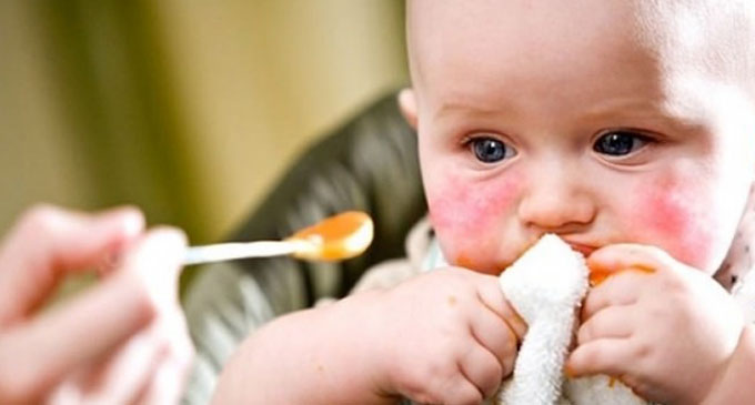 Food-induced anaphylaxis less severe in infants – Study