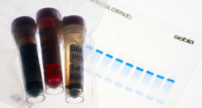 21 Athletes linked to blood-doping probe 21 Athletes linked to blood-doping probe