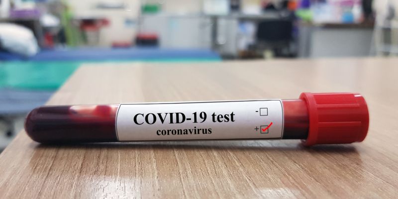 7 more Covid-19 cases reported; Toll rises to 1,085