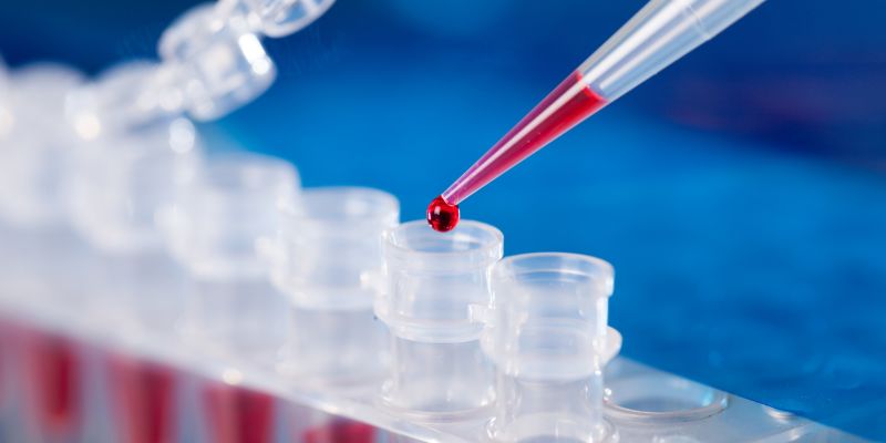 Nearly 2,000 PCR tests conducted in SL yesterday