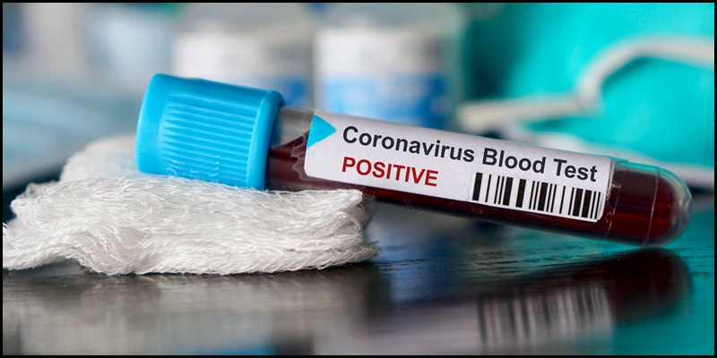 2 more test positive for COVID-19, cases up to 1,057