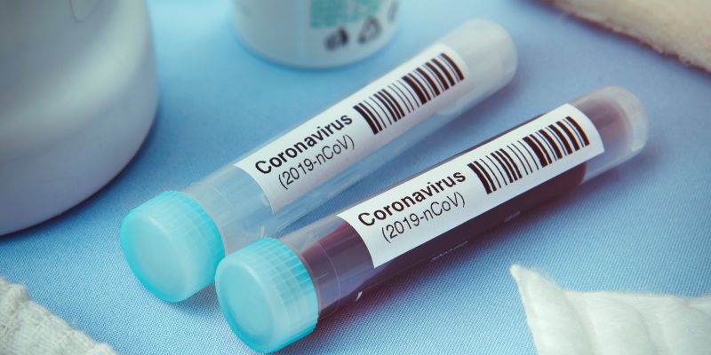 Two more persons test positive for COVID-19