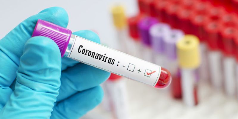 Five Kuwait returnees test positive for COVID-19 Five Kuwait returnees test positive for COVID-19
