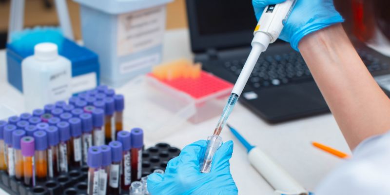 Over 84,000 PCR tests conducted in Sri Lanka