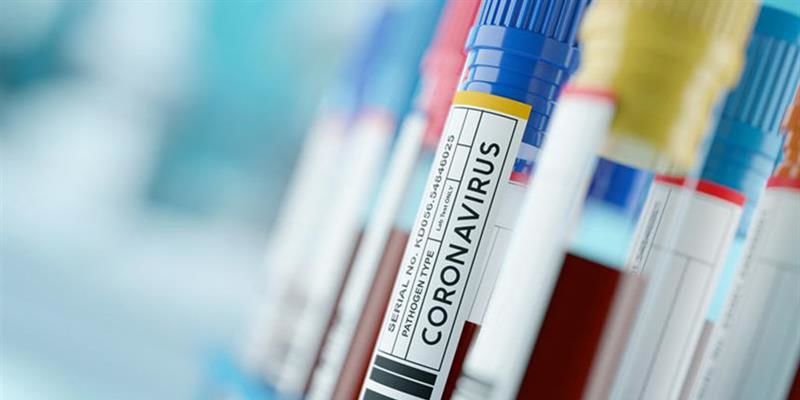 Coronavirus infections increase to 1,858