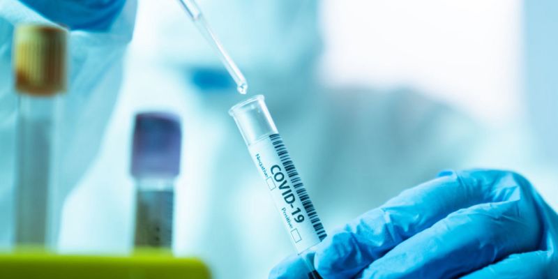 Over 81,000 PCR tests conducted in Sri Lanka