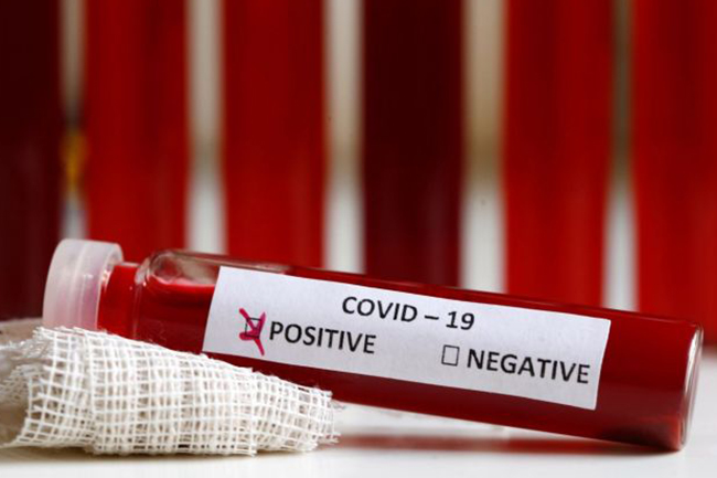 7 more coronavirus-infected navymen under medical care