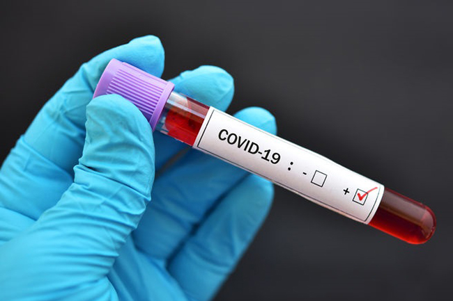 Iran Returnee tests positive for Covid-19, total cases sit at 2,094
