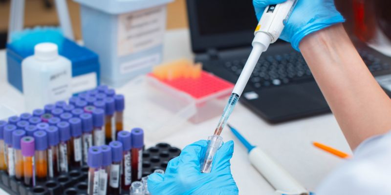 Over 130,000 PCR tests conducted in Sri Lanka