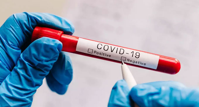 COVID-19 : 712 patients recovered