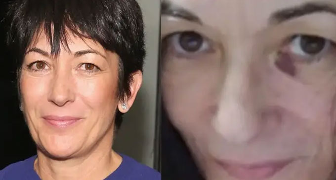 Ghislaine Maxwell prison photo shows bruised face